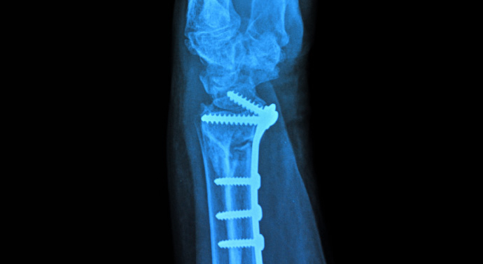 Medical